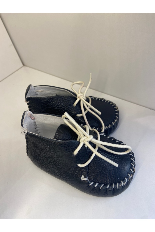 حديثي الولادة السوداء - 2