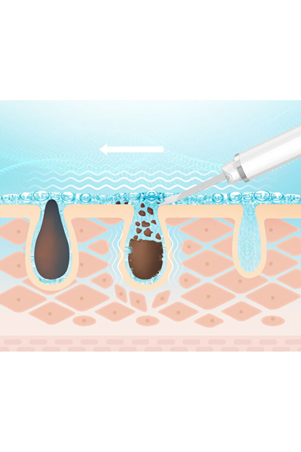 Cordless cavitation peeling device, solid cleansing set - 4