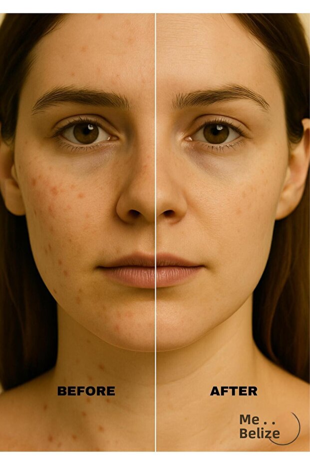 صابون بخلاصة الزنجبيل - 6