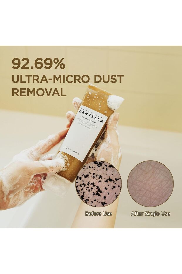 مدغشقر كينتيللا أمبولة رغوة - 3