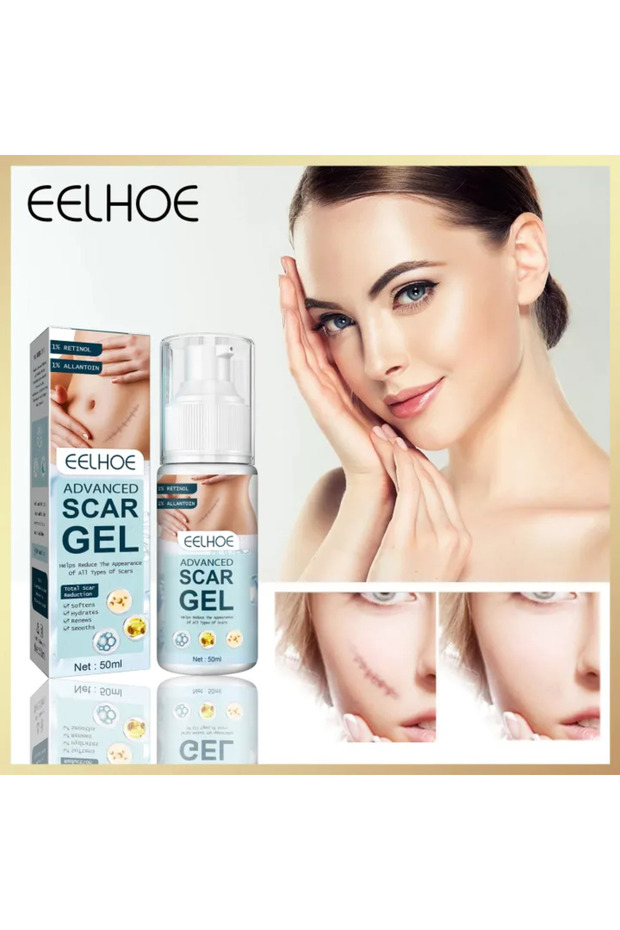 Advanced Scar Gel Effective Acne Scar Removal Face Cream Pimples Stretch Marks Remove Smoothi