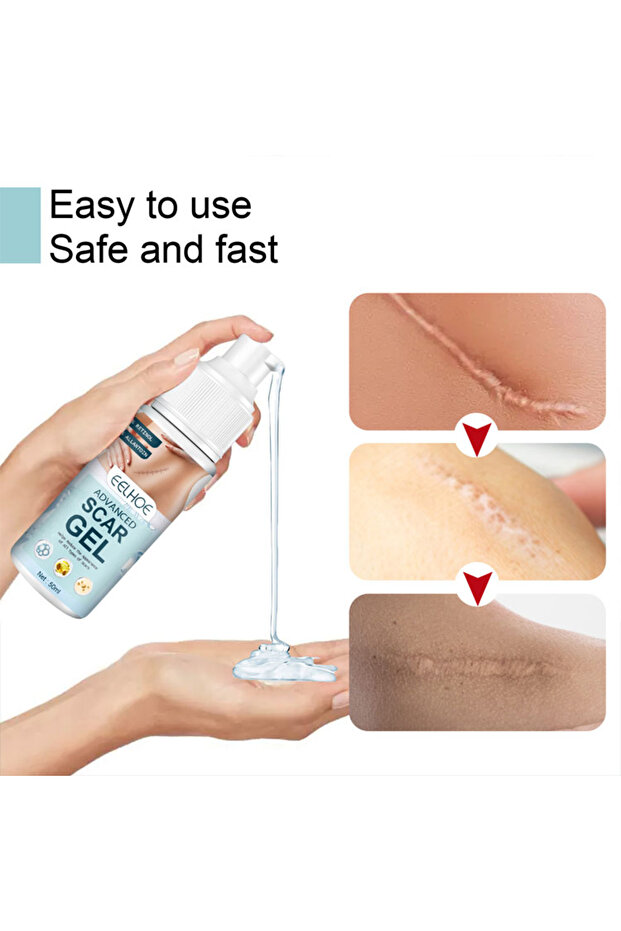 جل الندبات المتقدم - 3
