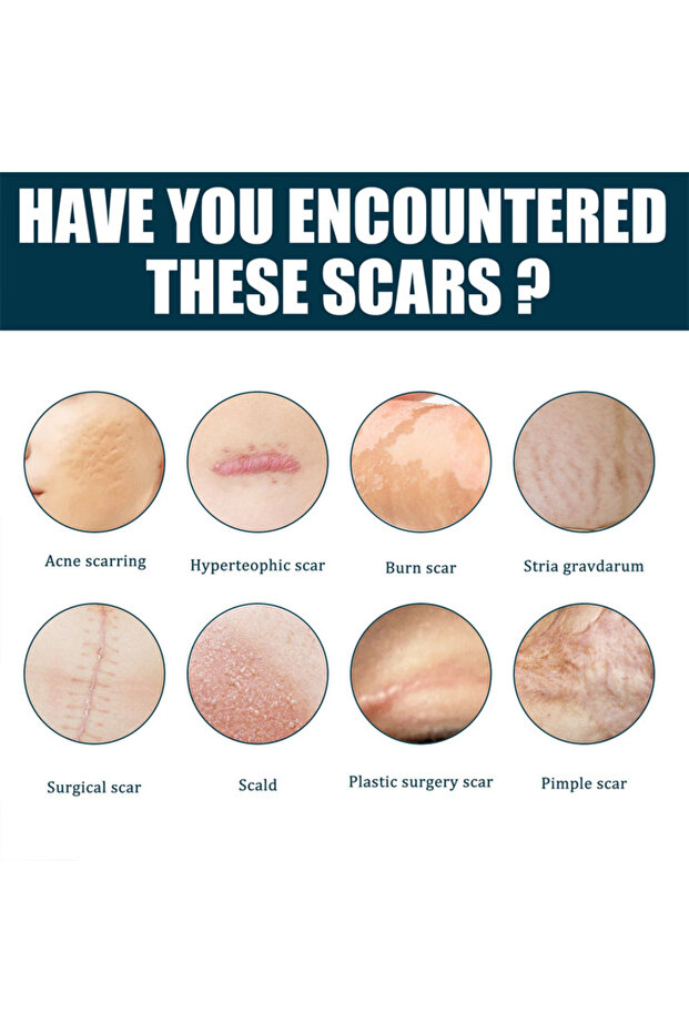 جل الندبات المتقدم - 2