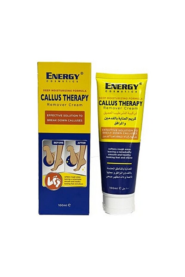 Callus Remover Cream Sj | 100 Ml