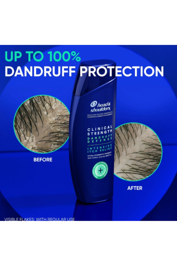 & Shoulders 2 ın 1 Clınıcal Strenght Dandruff Defense Intensıve Itch Relıef Şampuan 400 ml - 2