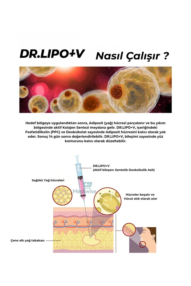 Dr Lipo Plus Mezoterapi Gıdı Eritme, Yanak inceltme - 1 Flakon 5 ml - 3