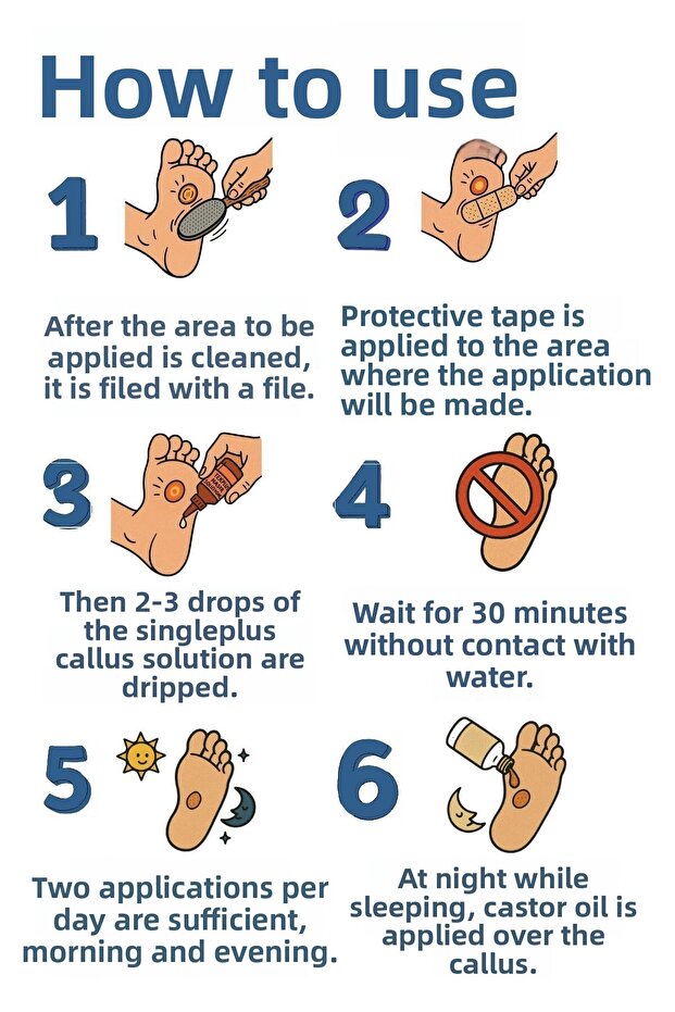 Callus Treatment Set - Remover, Solution and Remover - 2