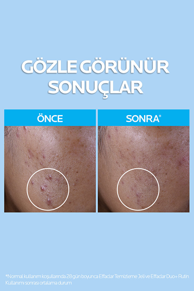 Effaclar Yağlı ve Akneye Eğilimli Citler için Temizleme Jeli 400 ml - 3