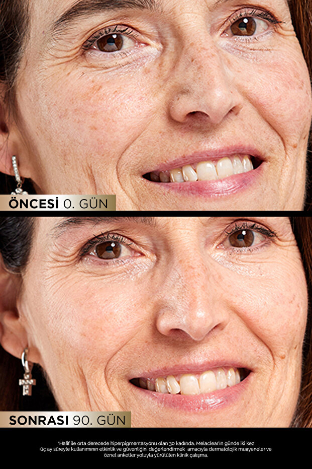 Melaclear Leke Karşıtı & Aydınlatıcı %3 Traneksamik Asit İçeren Jel Serum 30 ml - 2