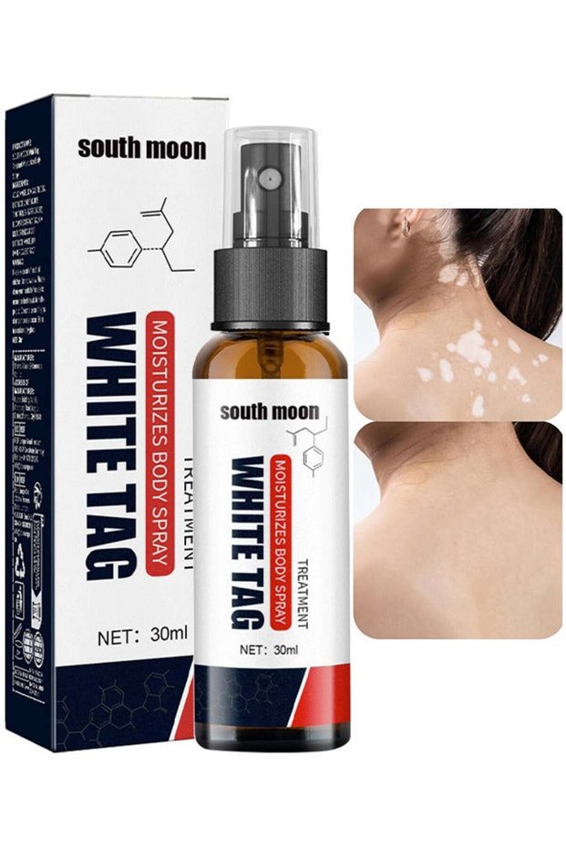 White Tag Moisturizes Body Spray, Skin Repair Spray, Promote Melanin Recovery, Reduces Wh