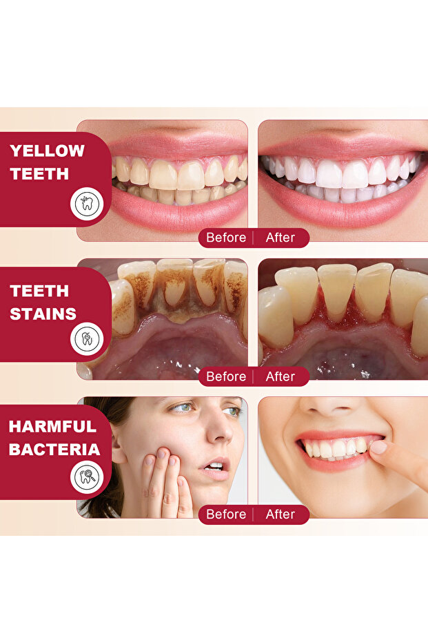 معجون أسنان Sp-4 - 4