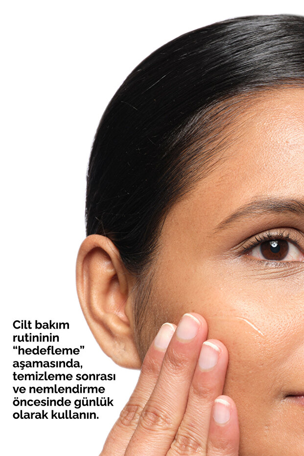 Aloe 2% + NAG 2% Solution - İzi Görünümüne Karşı Solüsyon - 3