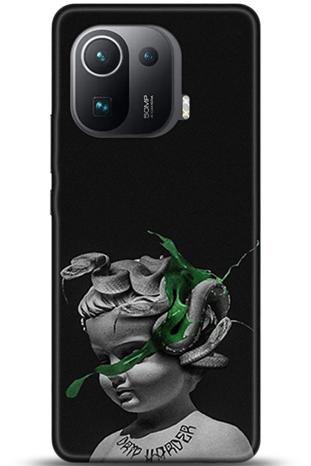 Xiaomi Mi 11 Pro Case Hd Printed Case - Keep Following 5077