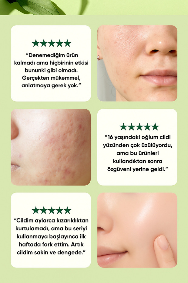 Pyunkang yul Ultimate Calming Solution Cream 30 ml - Upokojujúci a upokojujúci krém na tvár - 5