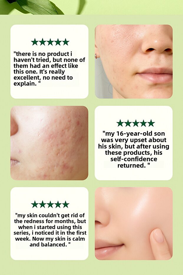 Pyunkang yul Ultimate Calming Solution Cream 30 ml - Καταπραϋντική και καταπραϋντική κρέμα προσώπου - 5