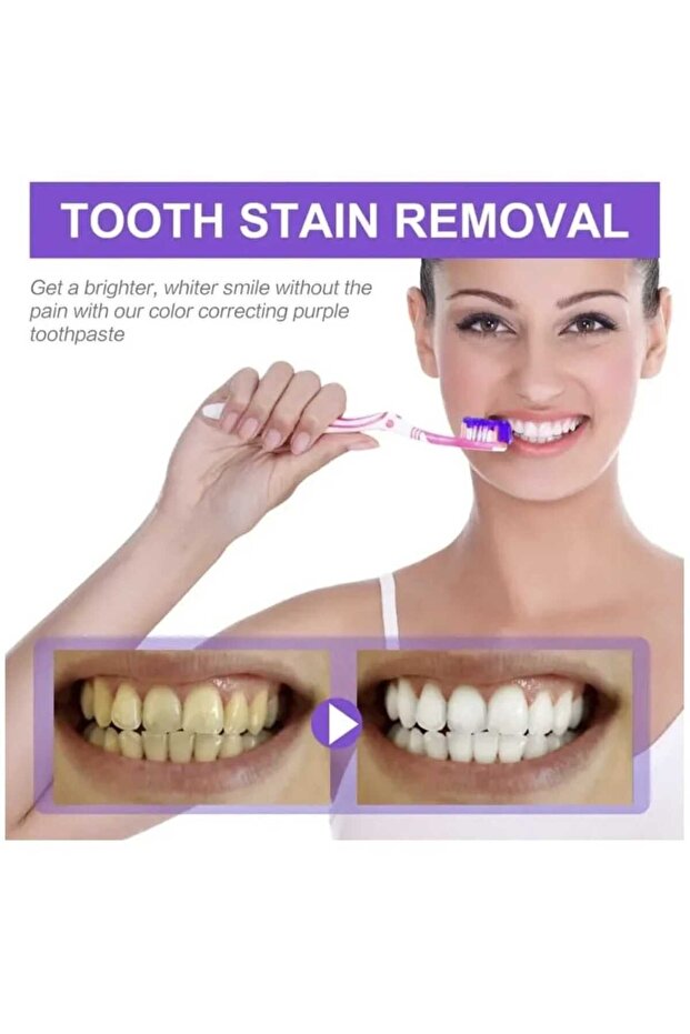Tooth Color Corrector, Purple Toothpaste - 1