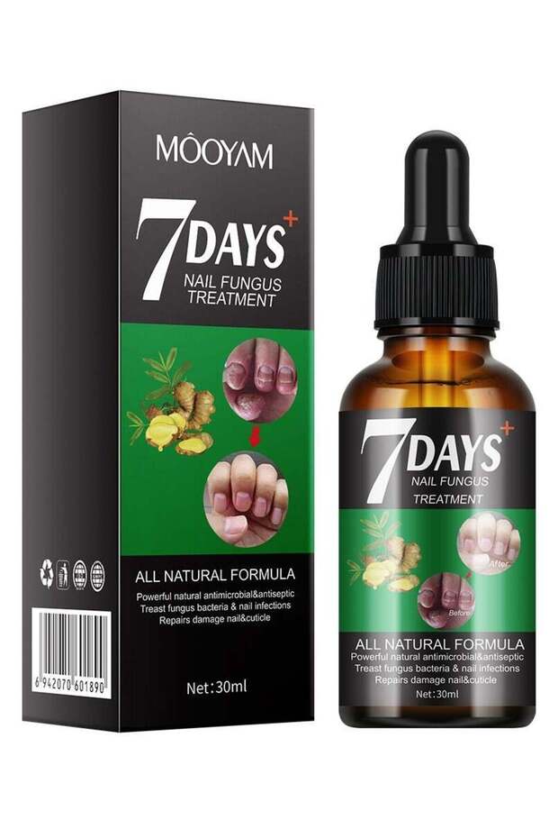 MOOYAM 7 Days Nail Fungus Treatment - 30ml