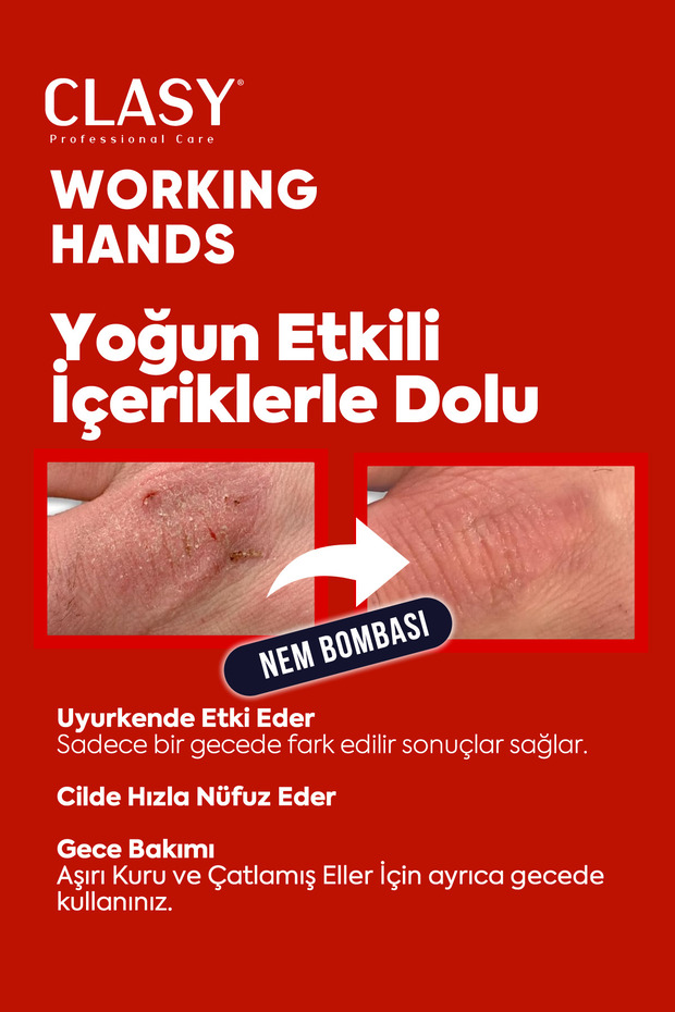 Working Hands Eller İçin Özel Yoğun Nemlendirici El Kremi - 8