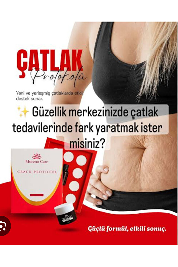 Çatlak Protokolü