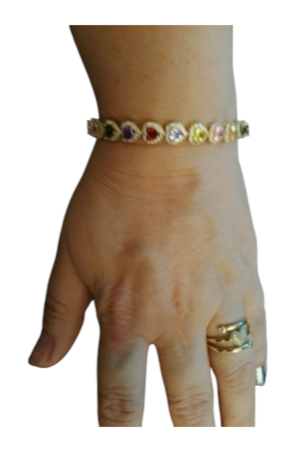 Επίχρυσο - 2