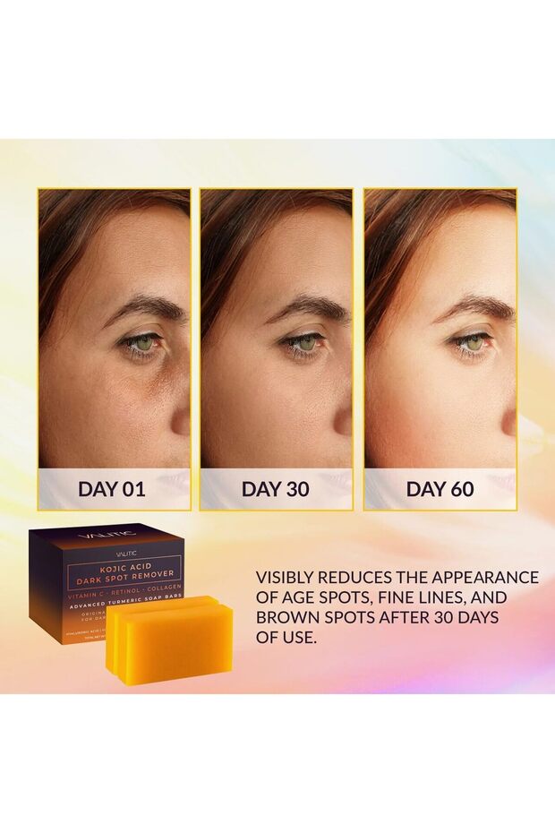 قالب صابون فالتيك - 2