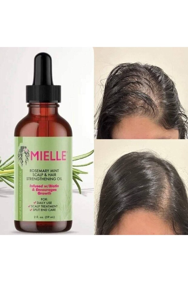 Organic Rosemary Rosemary and Mint Hair Strengthening Serum Oil Mint Scalp Hair Strengthening Oil 59 ml