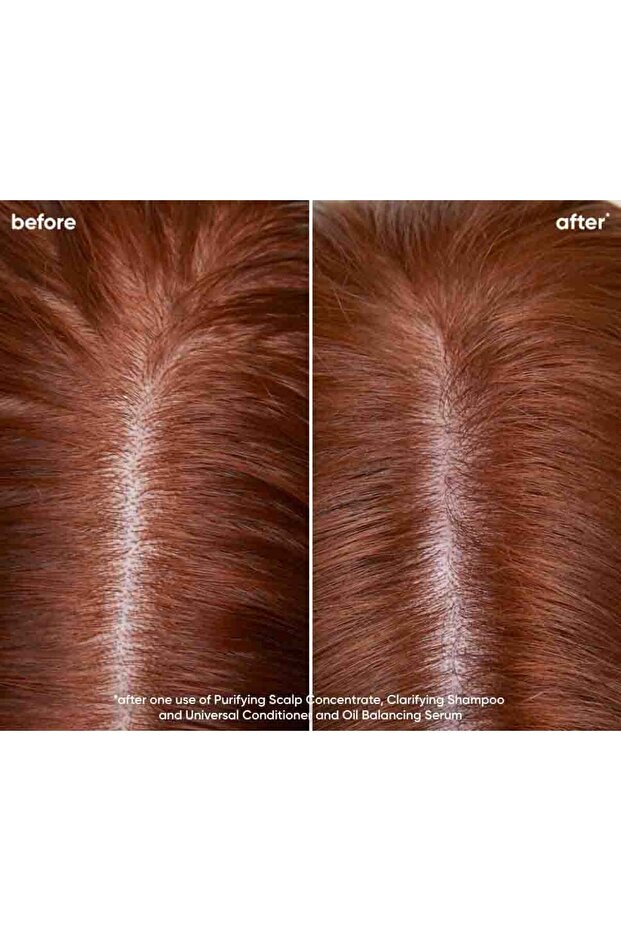 ,Scalp Sync Clarifying - Professional, Clarifying Shampoo, For Oily Scalp And Excess Sebum, 1000 ml - 3