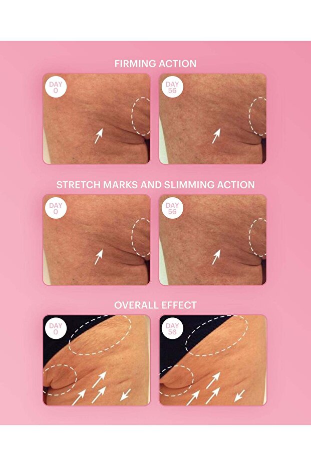 لوشن شد الثدي - 7