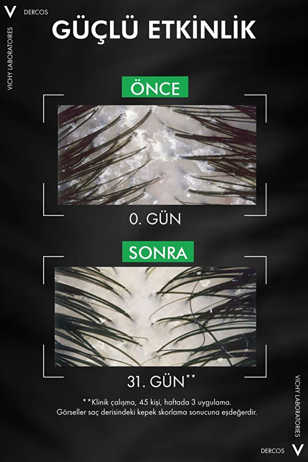 Dercos Normal ve Yağlı Saçlar için Salisilik Asit İçeren Kepek Karşıtı Şampuan 390 ml - 5