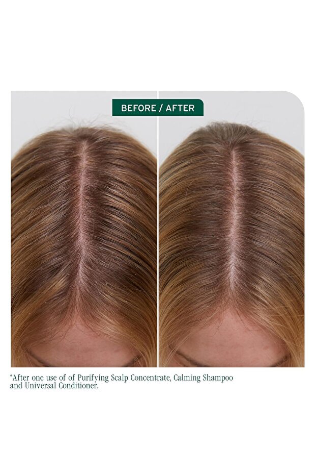 , Scalp Sync Calming Shampoo-Professional Calming Shampoo, For Sensitive Scalp, 1000 ml - 8