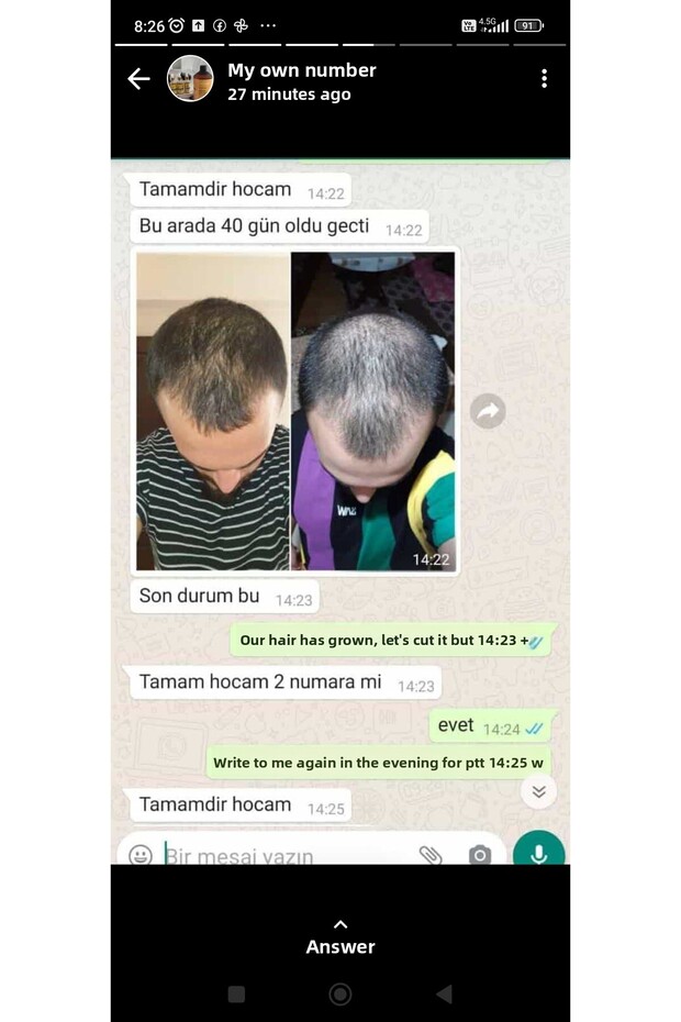 محلول الشعر الأشقر - 3