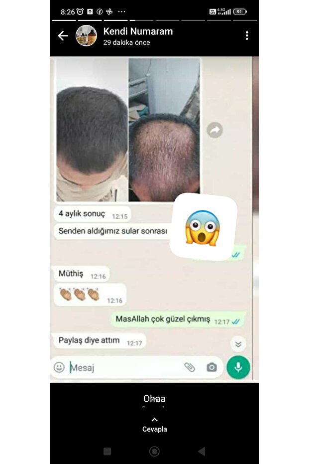 Sarı saç solusyonu - 3