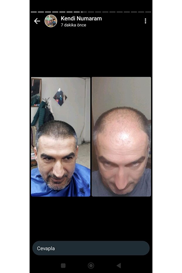 Sarı saç solusyonu - 7