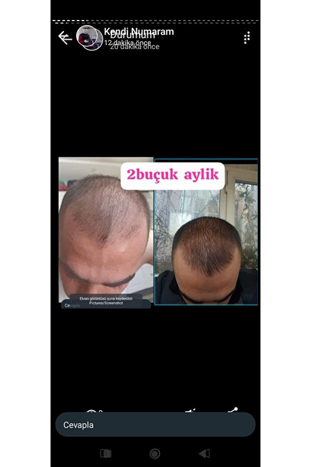 Sarı saç solusyonu - 5