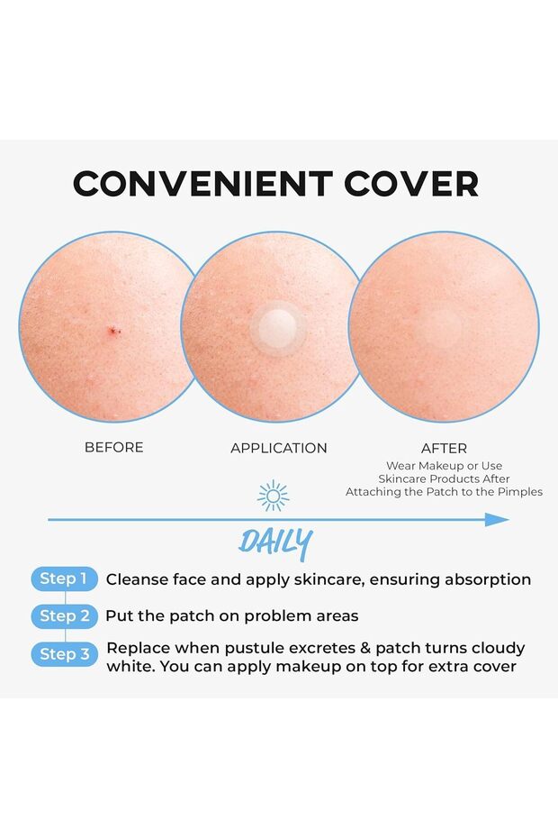 رقعة هيدروكولويد شفافة الخطوة 2 - 3