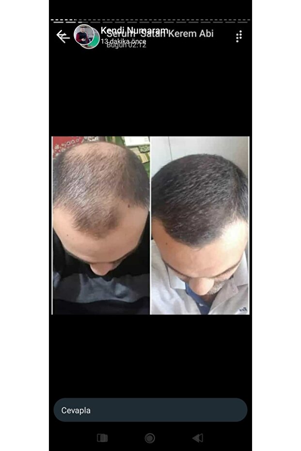 Sarı saç solusyonu - 6