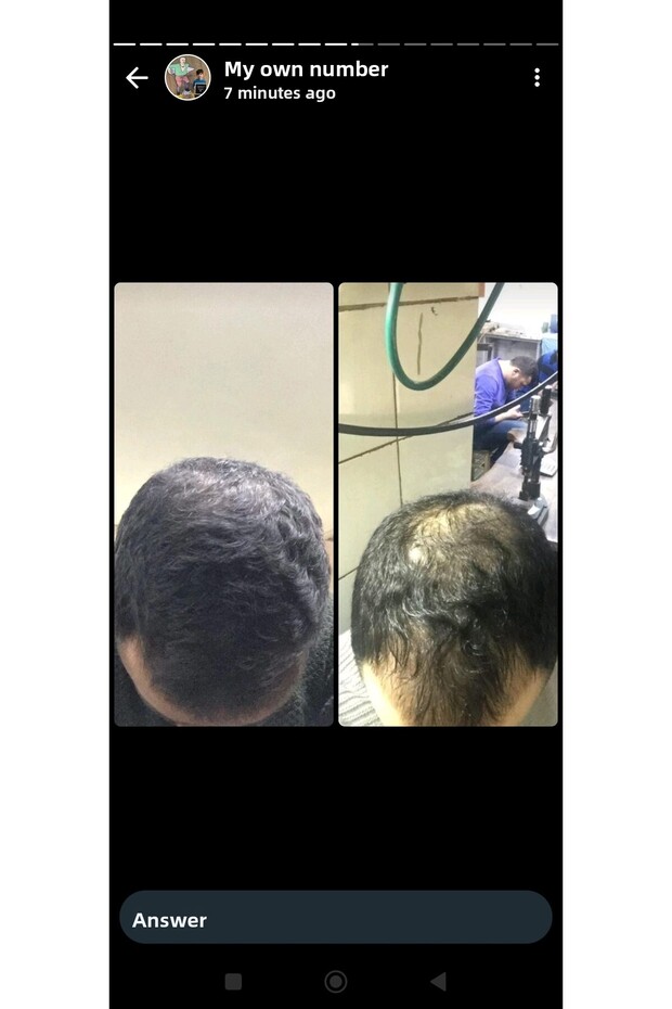 محلول الشعر الأشقر - 7