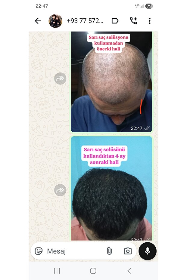 Sarı Saç Solusyonu - 6