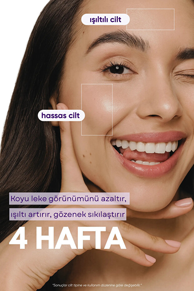 Leke Karşıtı Serum 30 ml | Traneksamik Asit, Alpha Arbutin, Niacinamide ve C Vitamini ile Ton Eşitsizliği ve Koyu Leke Görünümü Bakımı - 4