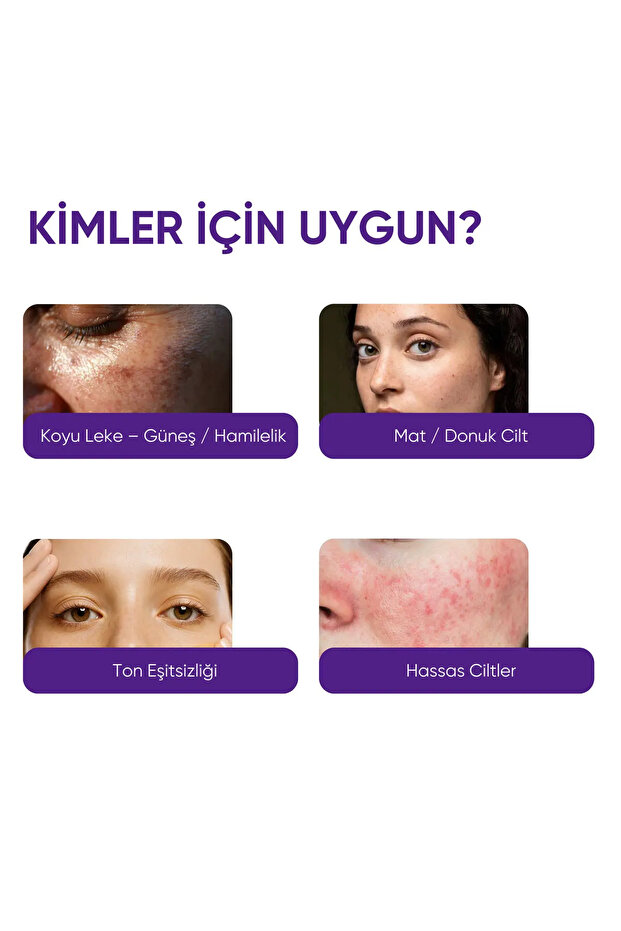Leke Karşıtı Serum 30 ml | Traneksamik Asit, Alpha Arbutin, Niacinamide ve C Vitamini ile Ton Eşitsizliği ve Koyu Leke Görünümü Bakımı - 9