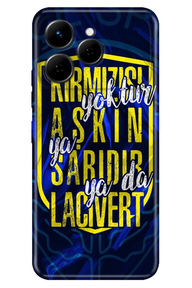 Spark 40 4g (Km5N) Case Art Silicone Printed Tpu Color of Love Yellow Navy Blue