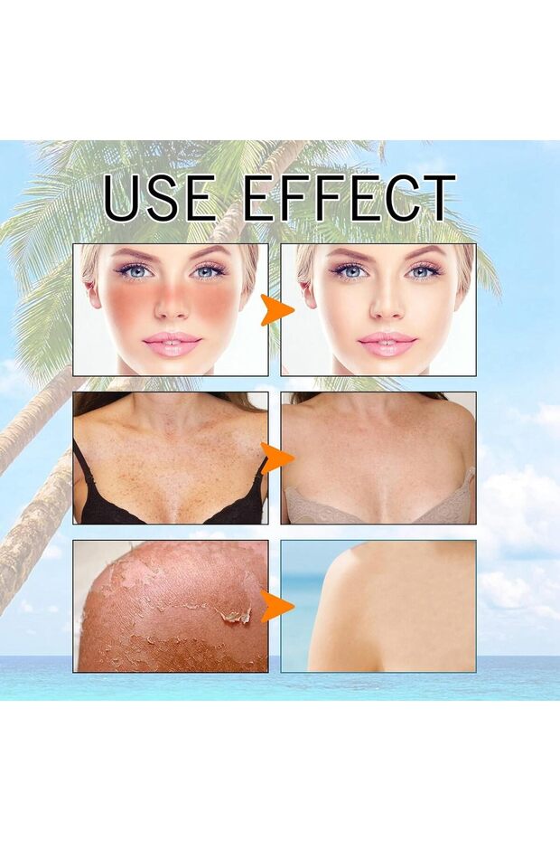 جل مرطب للوجه واقي من الشمس (عبوة من قطعتين) - 4