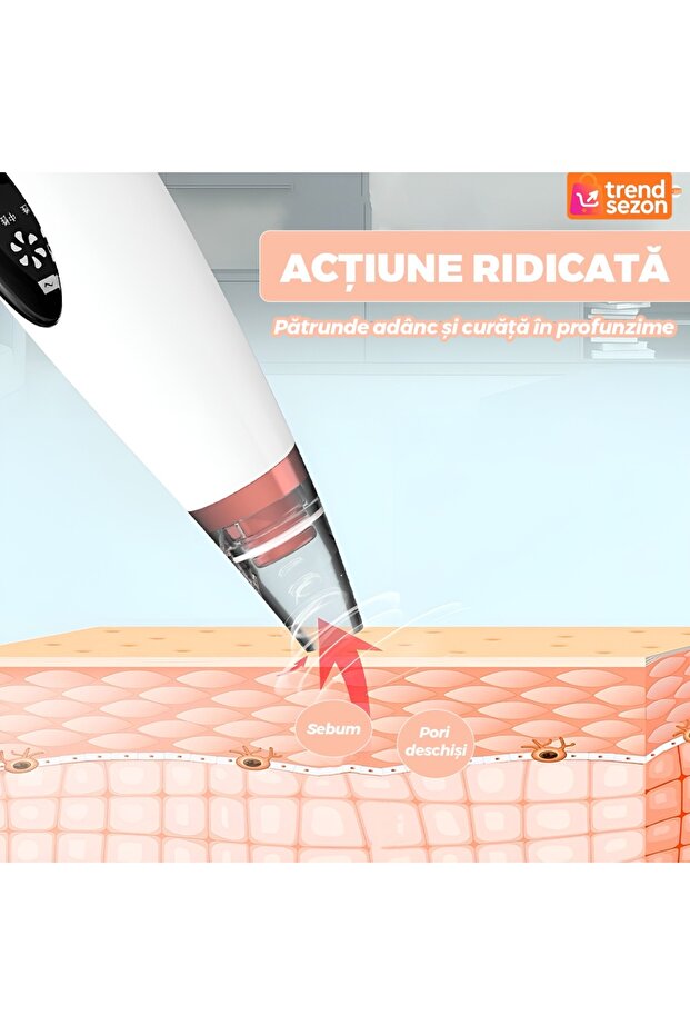 Blackhead Removal Device - 6