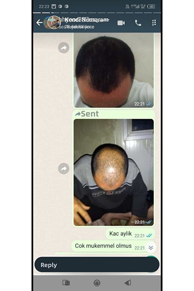 Blonde Hair Solution - 4