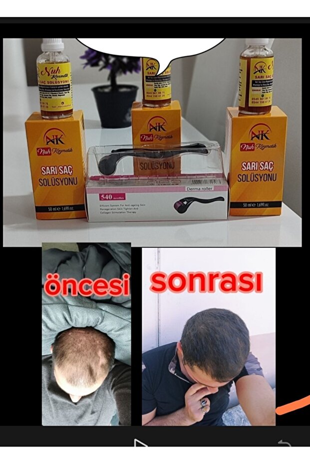 Sarı saç solusyonu - 4