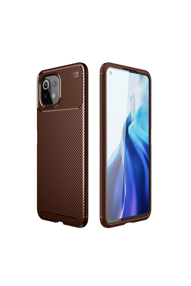 Xiaomi Mi 11 Lite Case Unique Textured High-Grip Matte Elite Cover