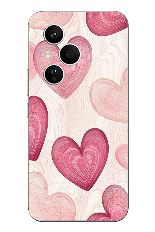 حافظة سيليكون متوافقة مع Honor 400 PRO باللون الوردي الخطوي مطبوع - 1