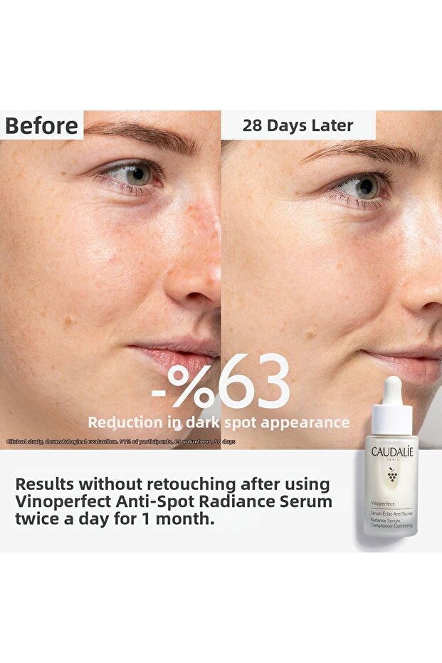 Vinoperfect Serum 30 ml - 4