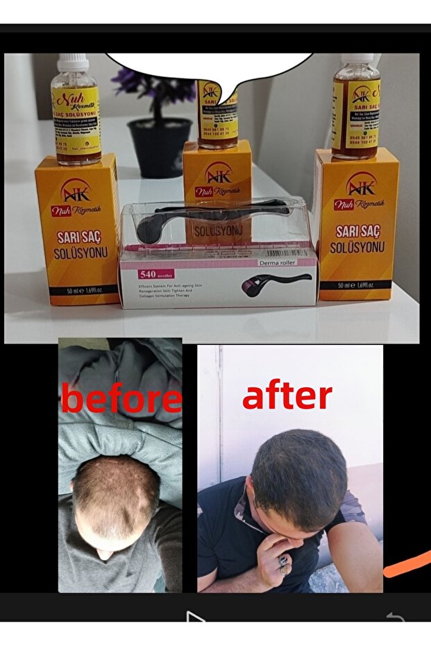 Blonde Hair Solution - 3
