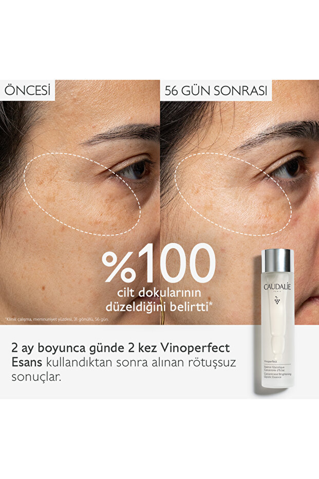 Vinoperfect Esans 150 ml - 2